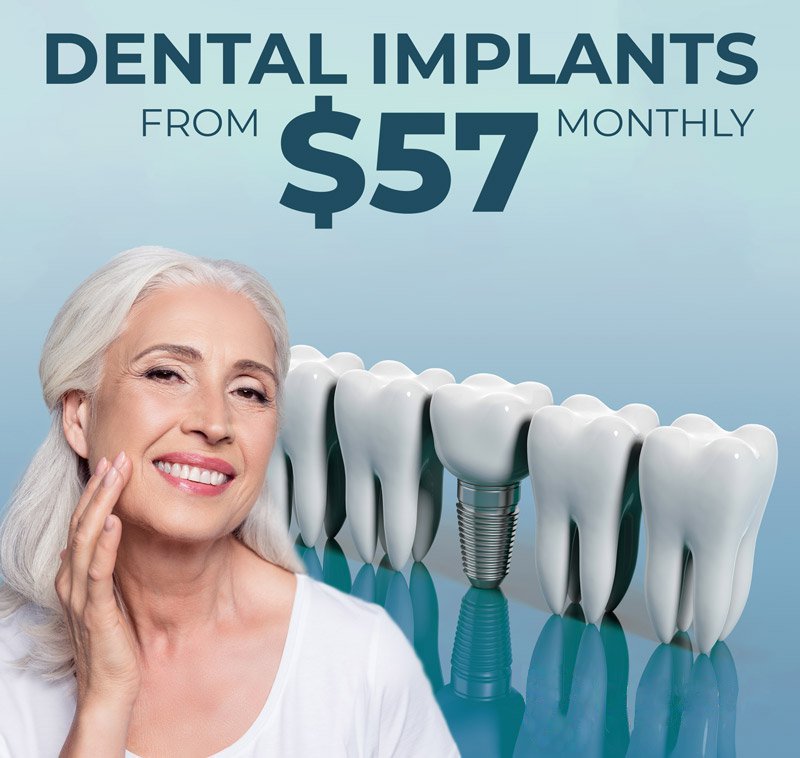 Dental Implant Boynton Beach