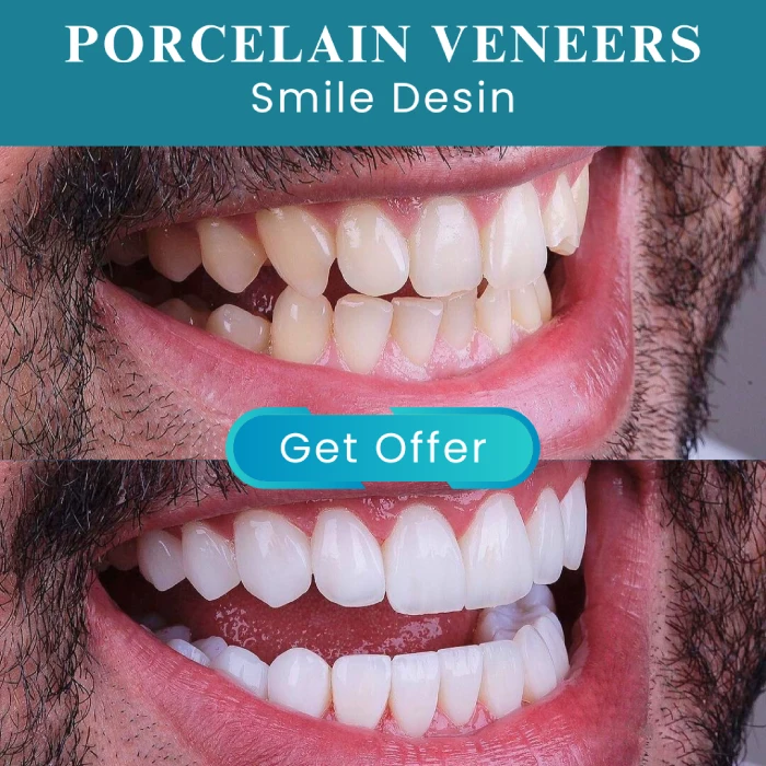 boynton beach dental services Before and After